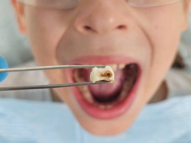 Best Walk-In Emergency Dental Services in Shell Valley, ND
